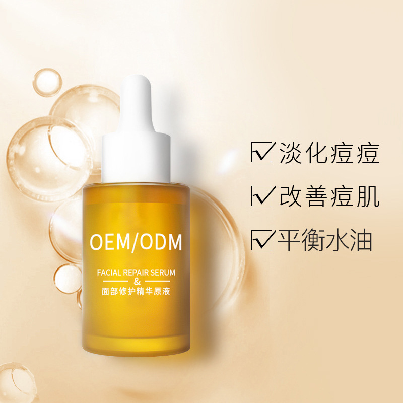 辽宁_祛痘精华原液OEM